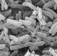 Найден микроорганизм, питающийся железом при +120 С  